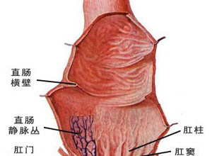 肠管变形