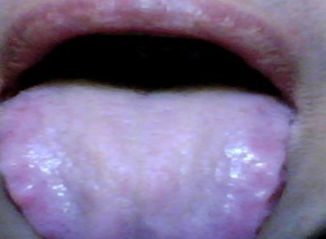 唇厚舌大