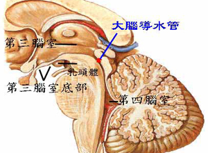 导水管周围受损