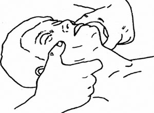 低氧血症