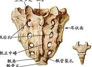 骶尾椎融合