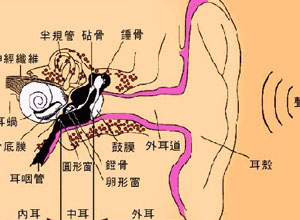 耳蜗性耳聋