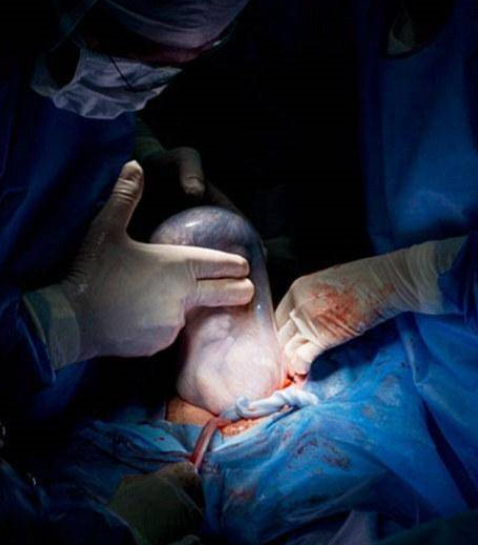 女人是怎么生孩子的？看过这些图的男人都哭了……