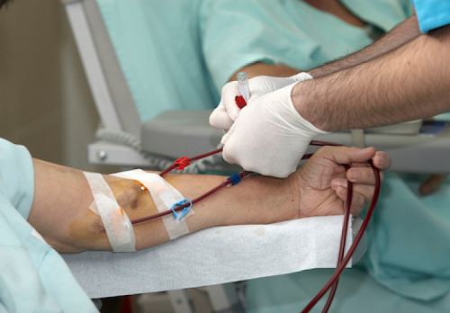 输血可能致命！存储期达6周的血液，其含铁量达危险水平