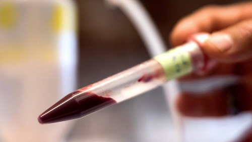 用人造血液可以替代人体血液？