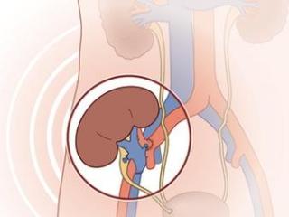 儿童器官移植现状：供体多 受体少 专家呼吁儿童肾移植