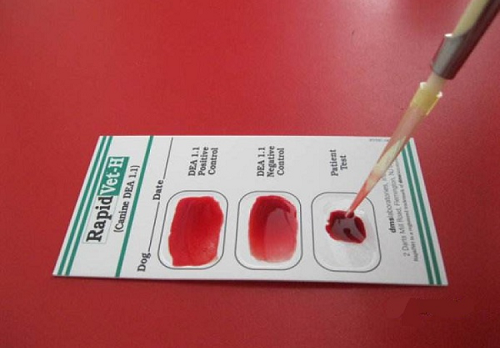 厉害啦！中国科学家研制出最快30秒测血型试纸卡