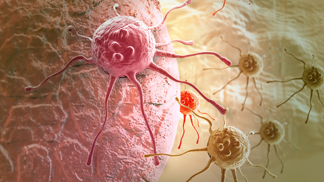 癌细胞的生存法则——免疫逃逸