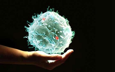 实体瘤的CAR-T细胞治疗_拓诊卫生资讯