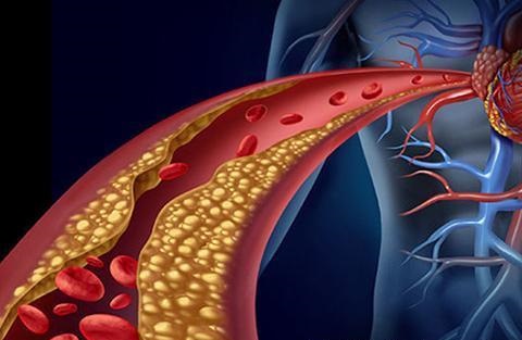 心脏病患者更易形成血栓 血栓有哪些致命危害？