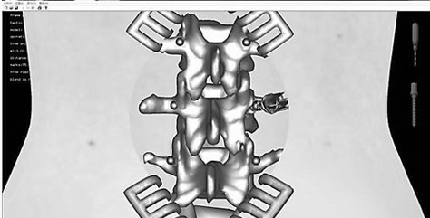虚拟骨科手术：借“虚”减缓“实”的疼痛_拓诊卫生资讯
