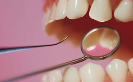 牙周炎的六个护理方法_拓诊卫生资讯