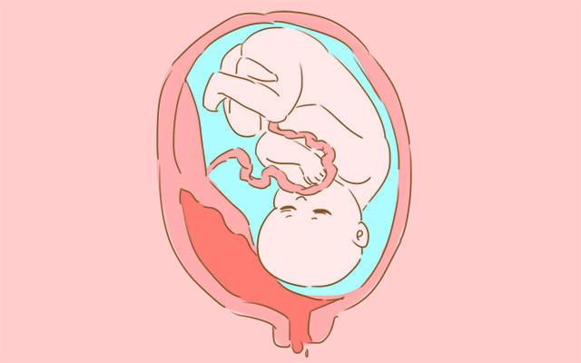 孕期出现这4种症状的人大多会生女儿，想要女儿的宝妈快来看