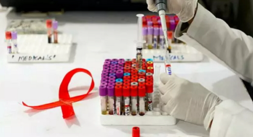 长效注射型HIV疗法通过临床试验