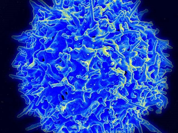 科学家发现开启免疫细胞强大肿瘤杀伤力的重要“开关”！