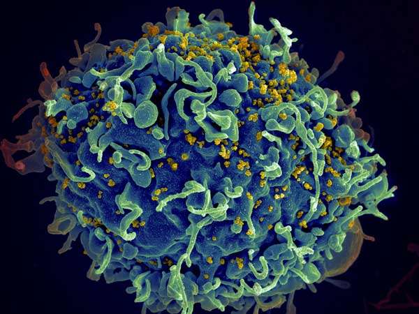 人体早期试验正在测试一种能制服潜伏HIV病毒的抗癌药物！