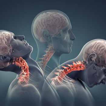 这四种症状的出现，说明你有颈椎病了_拓诊卫生资讯