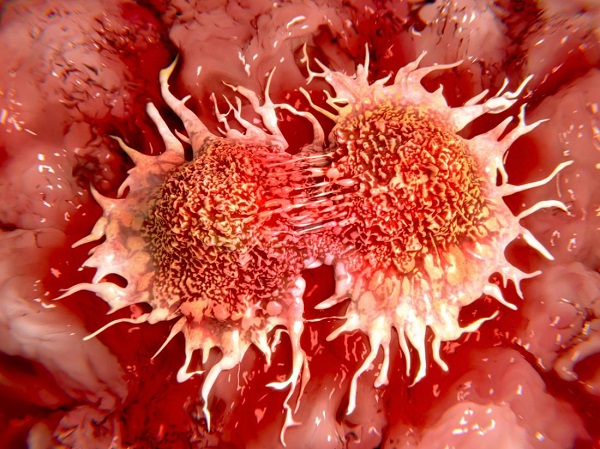 科学家找到阻止癌症蔓延的关键