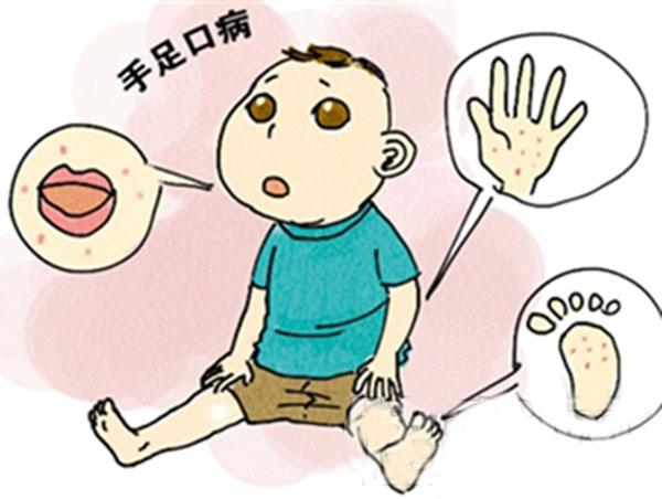 手足口病危害有哪些 手足口病重在防控_拓诊卫生资讯