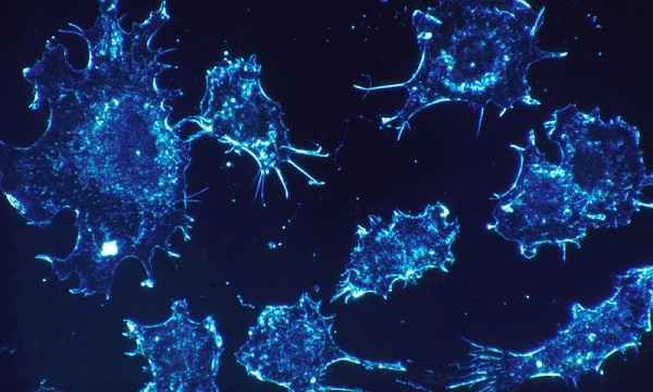 科学家发现:癌症治疗失败的关键“细胞睡眠”