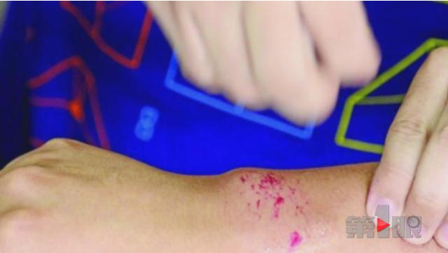 男子自称神医 不动手术就能把体内淤血清除_拓诊卫生资讯