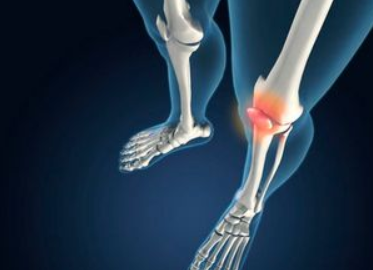 膝关节炎的治疗方法都有哪些？